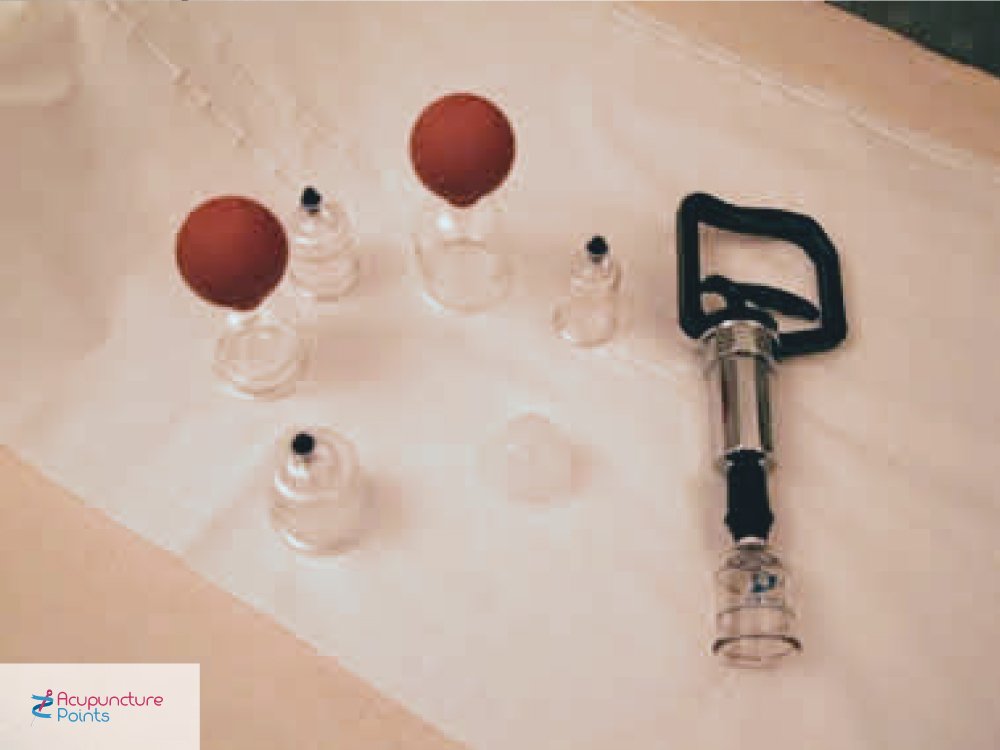 Cupping Hygiene