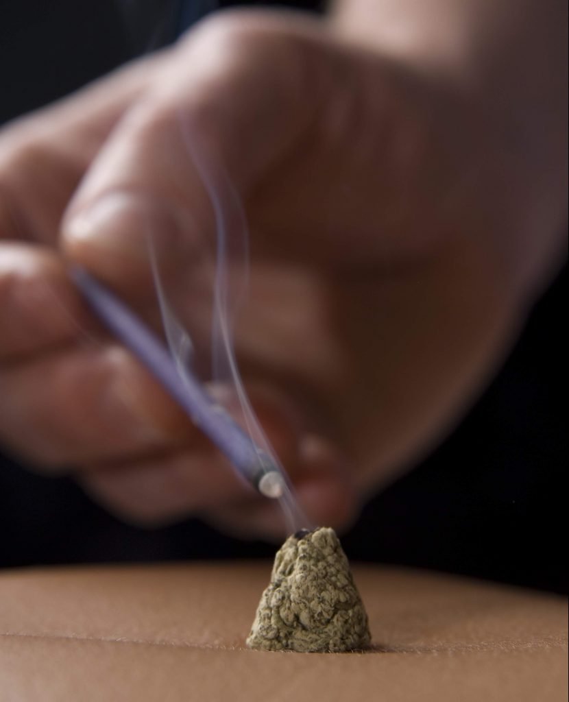 Lighting Moxa Cone to assist immune system vs ill effects of antibiotics