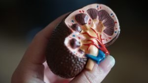 Plastic Kidney
