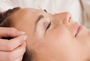 Cosmetic acupuncture
