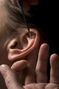 Probe testing Shenmen for ear acupuncture