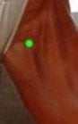 Liver 11