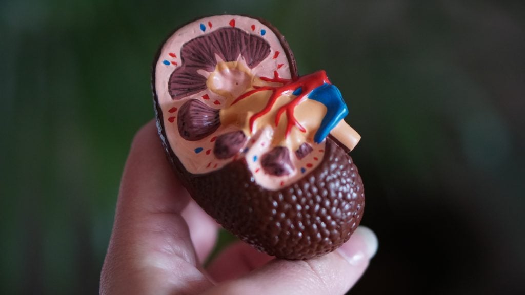 Plastic Kidney