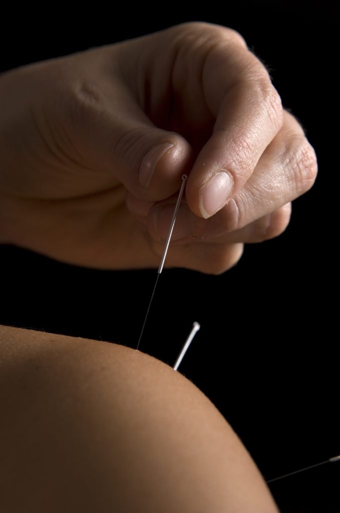 Acupuncture at shoulder for bright yang stage treatment