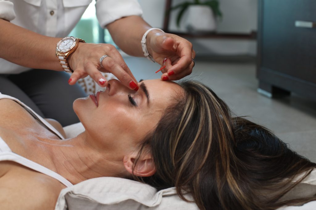 There are similarities between acupuncture and how Bowen works.