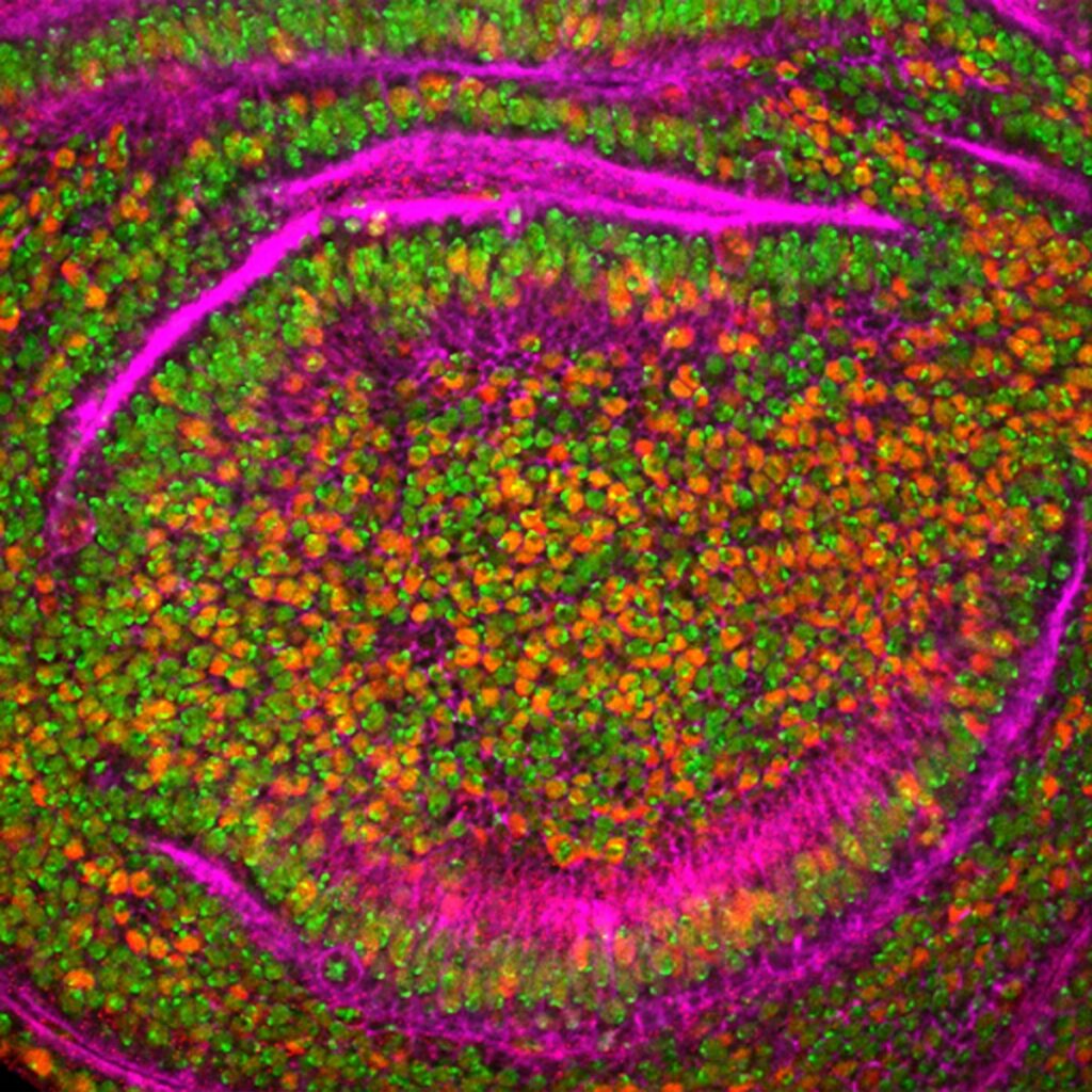 drugs to reduce yang may also produce erectile dysfunction
