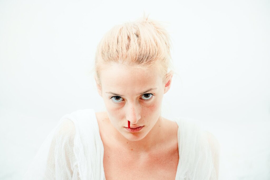 Epistaxis nose bleed - one symptom of Heat Victorious agitates Blood